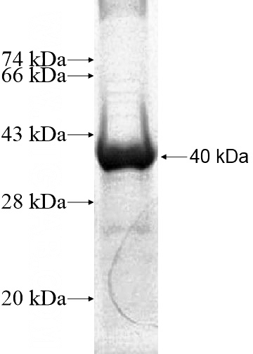 Recombinant Human ZNF485 SDS-PAGE