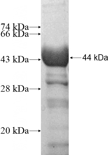 Recombinant Human DYNC1LI2 SDS-PAGE