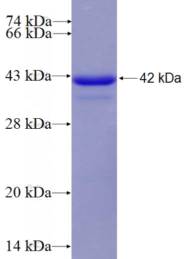 Recombinant Human DACH1 SDS-PAGE