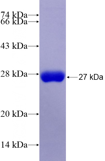 Recombinant Human HDC SDS-PAGE