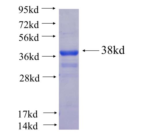 Recombinant Arabidopsis thaliana DCL4 SDS-PAGE