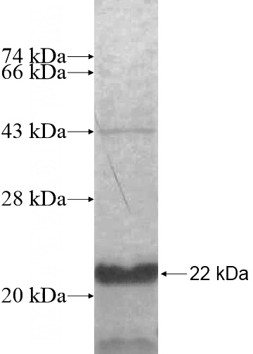 Recombinant Human NHEDC1 SDS-PAGE