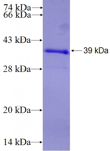 Recombinant Human IKZF3 SDS-PAGE