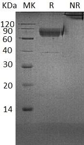 Human CD300A/CMRF35H/IGSF12/HSPC083 (Fc & His tag) recombinant protein