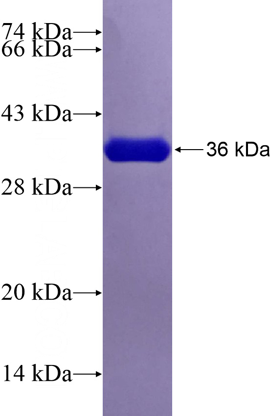Recombinant Human RSPO4 SDS-PAGE