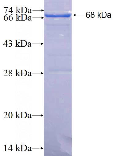Recombinant Human MCC SDS-PAGE
