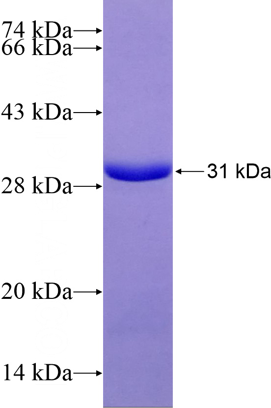 Recombinant Human ATG7 SDS-PAGE