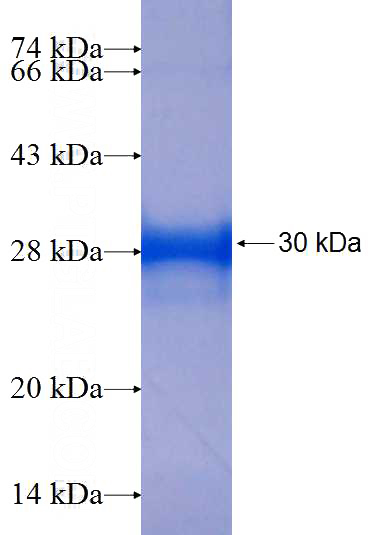 Recombinant Human CCRK SDS-PAGE