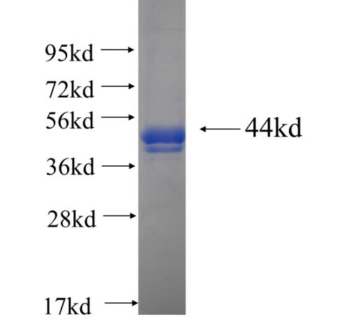 Recombinant human GNPAT SDS-PAGE