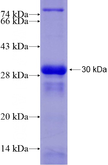 Recombinant Human SIK1 SDS-PAGE