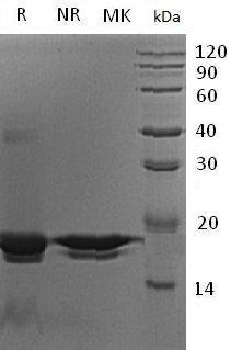 Human PPIH/CYP20/CYPH (His tag) recombinant protein