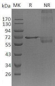 Human METAP2/MNPEP/P67EIF2 (His tag) recombinant protein