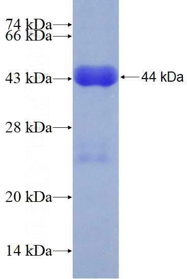 Recombinant Human LAMC1 SDS-PAGE