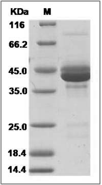 Human CALCA / CGRP Protein (Fc Tag) SDS-PAGE