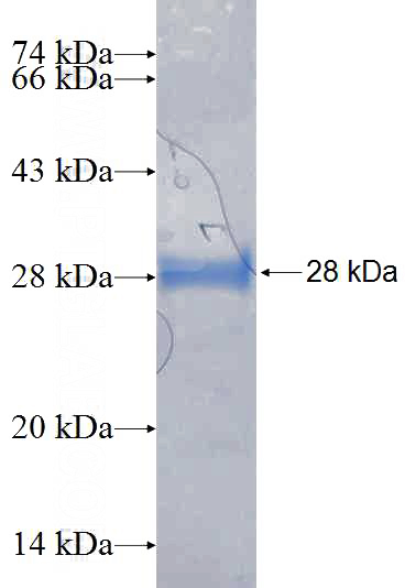 Recombinant Human RAB3GAP2 SDS-PAGE