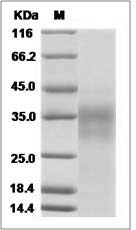 Human CD153 / CD30L / TNFSF8 Protein