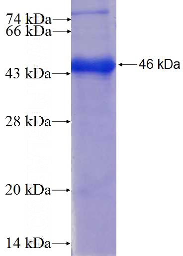 Recombinant Human THBD SDS-PAGE
