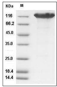 Mouse ACE2 / Angiotensin-Converting Enzyme 2 Protein (His & Fc Tag) SDS-PAGE