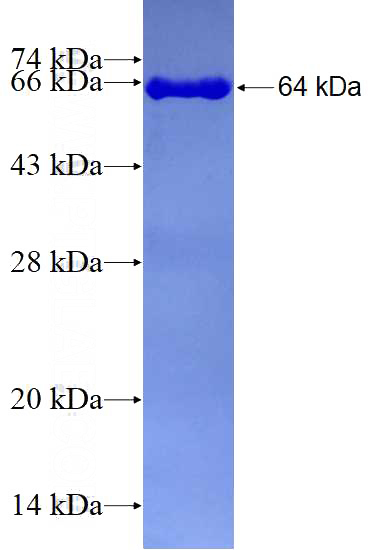 Recombinant Human OAS1 SDS-PAGE