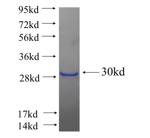 Recombinant human A4GNT SDS-PAGE