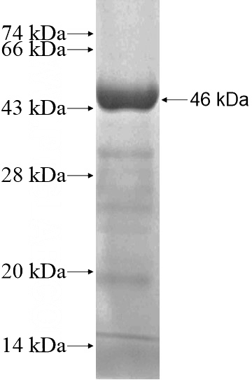 Recombinant Human DDX58 SDS-PAGE