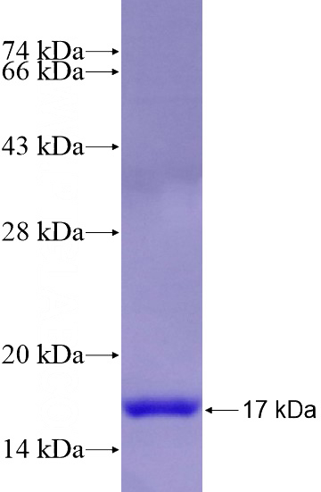 Recombinant Human ASB17 SDS-PAGE