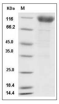 Human IFNAR1 / IFNAR Protein (Fc Tag) SDS-PAGE