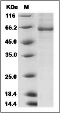 Human BBOX1 / Gamma-BBH Protein (His & GST Tag) SDS-PAGE