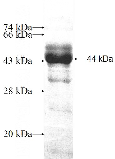 Recombinant Human ZNF259 SDS-PAGE