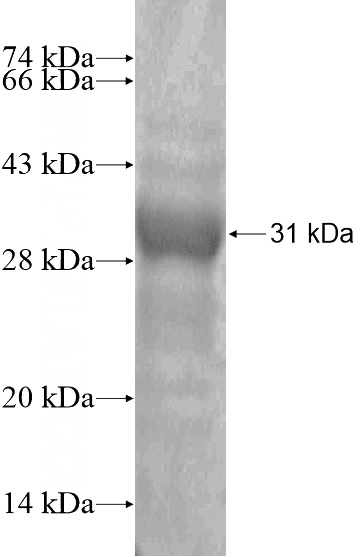 Recombinant Human SPSB1 SDS-PAGE