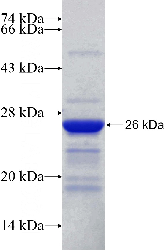 Recombinant Human MXI1 SDS-PAGE