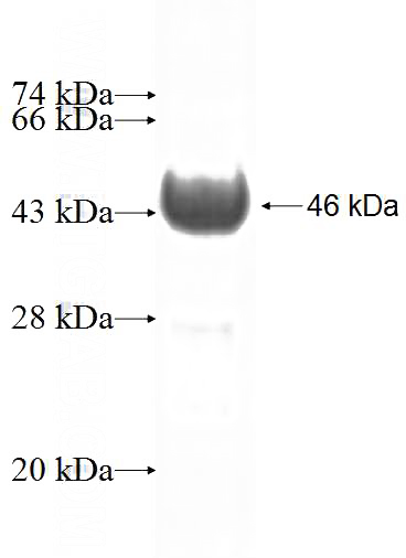 Recombinant Human Integrin beta-8 SDS-PAGE