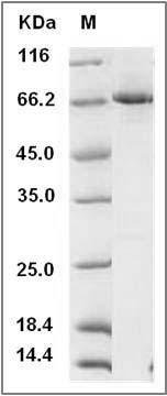 Mouse DDR1 Kinase / MCK10 / CD167 Protein (His & GST Tag) SDS-PAGE