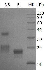 Mouse Vegfd/Figf (His tag) recombinant protein