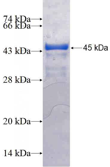 Recombinant Human ALX3 SDS-PAGE
