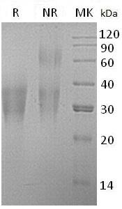 Human CD300A/CMRF35H/IGSF12/HSPC083 (His tag) recombinant protein
