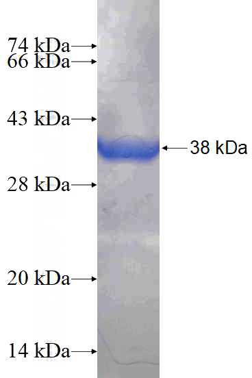 Recombinant Human PIP4K2B SDS-PAGE