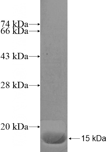 Recombinant Human R3HDML SDS-PAGE