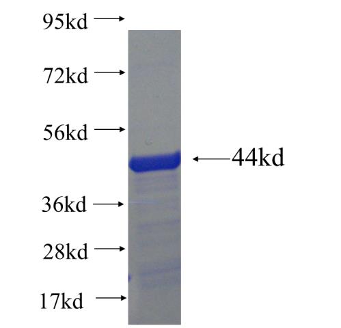 Recombinant human BAZ1B SDS-PAGE