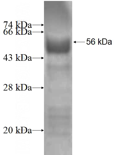 Recombinant Human FBXL18 SDS-PAGE
