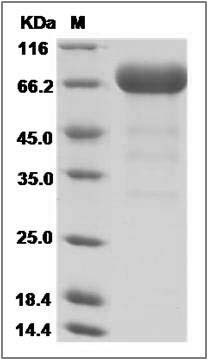 Mouse EphA3 Protein (His Tag) SDS-PAGE