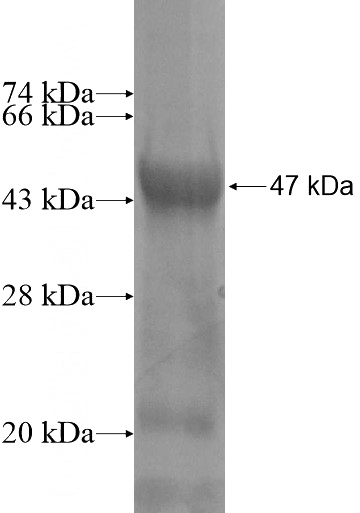 Recombinant Human SPATA22 SDS-PAGE