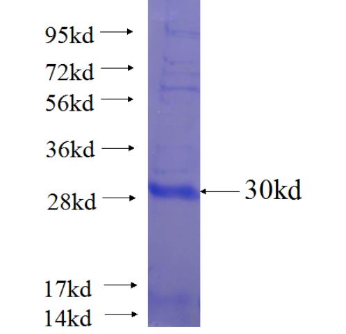 Recombinant Arabidopsis thaliana RICE1 SDS-PAGE