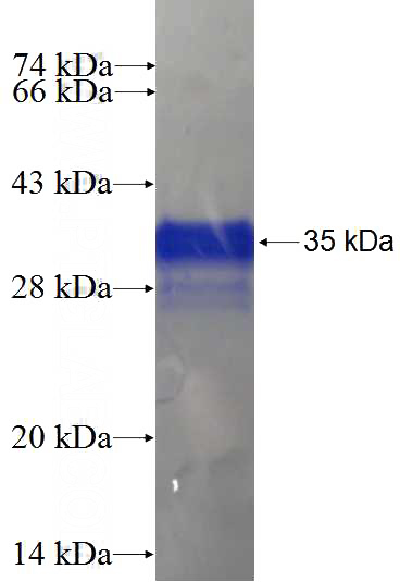 Recombinant Human AES SDS-PAGE
