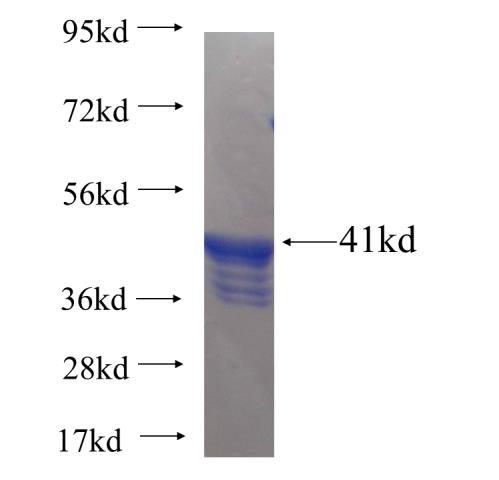 Recombinant Arabidopsis thaliana DHDPS1 SDS-PAGE