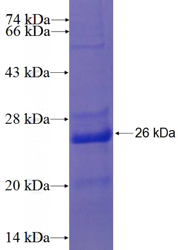 Recombinant Human RNASE9 SDS-PAGE