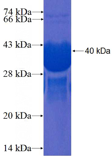Recombinant Human SNCB SDS-PAGE
