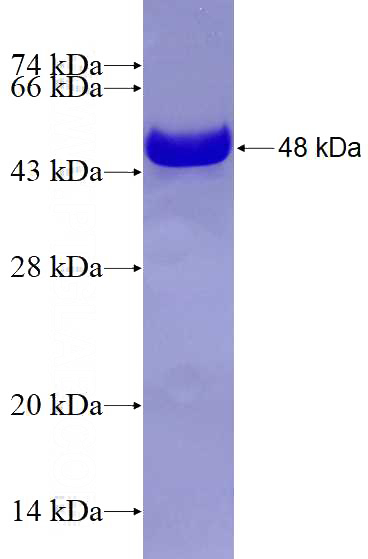 Recombinant Human RUNX1T1 SDS-PAGE
