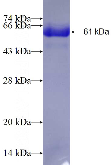 Recombinant Human MYOT SDS-PAGE
