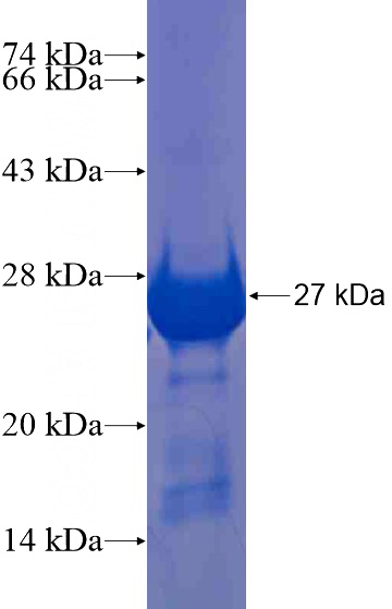 Recombinant Human FARP1 SDS-PAGE